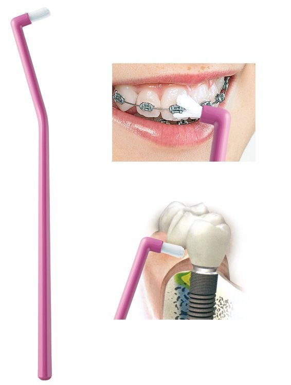 можно ли электрической зубной щеткой чистить импланты